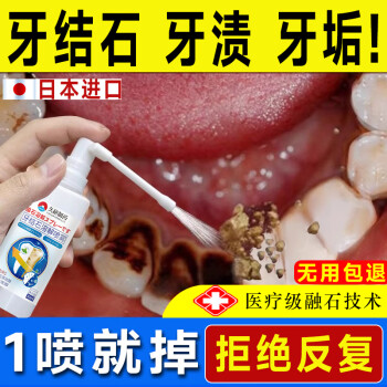 DRIRS 牙結(jié)石型口腔沖洗器噴霧牙齒膏去味口臭去黃溶解去漬牙石速效30ml